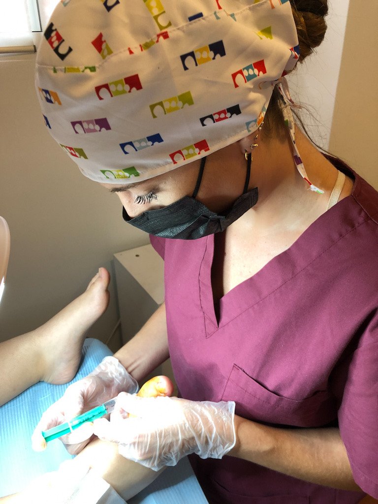 Resultado post-operatorio de cirugía de uña en podología