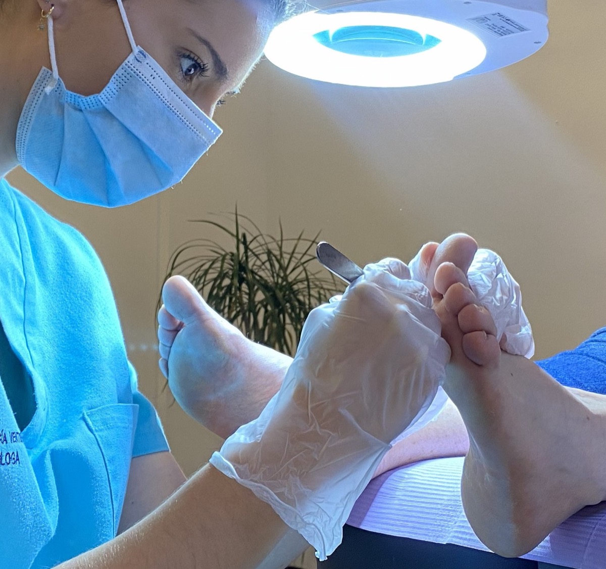 Verruga plantar tratamiento podológico